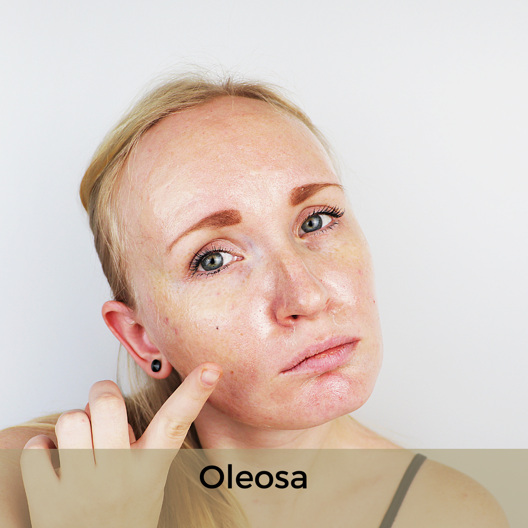 Como você descreveria a sua pele facial? Selecione quantas alternativas desejar.