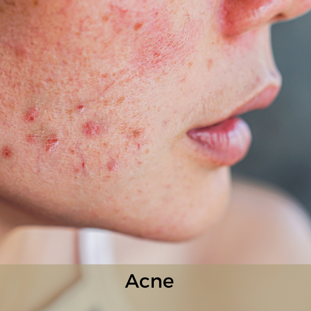 Quais problemas em relação a sua pele facial te preocupam hoje? Selecione quantas alternativas desejar.