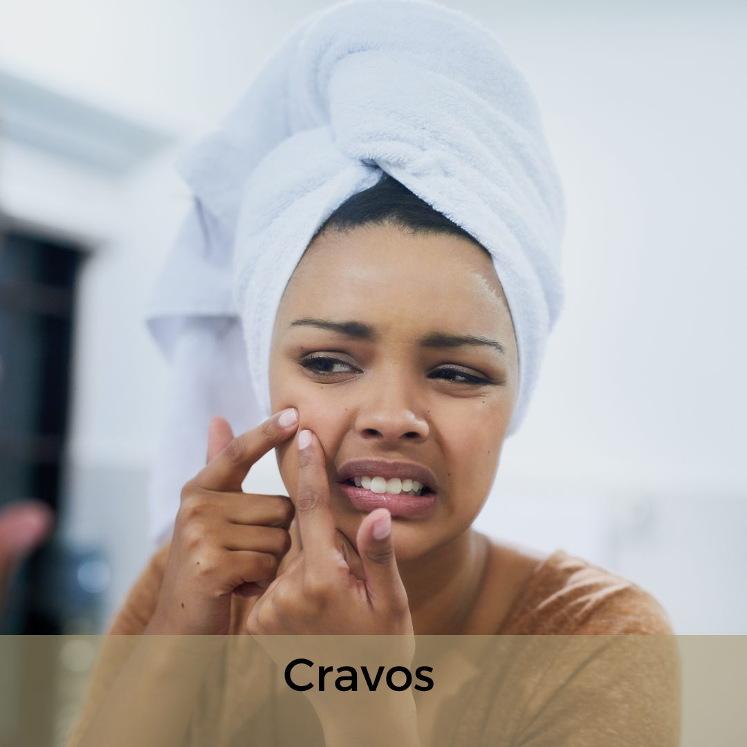 Quais problemas em relação a sua pele facial te preocupam hoje? Selecione quantas alternativas desejar.