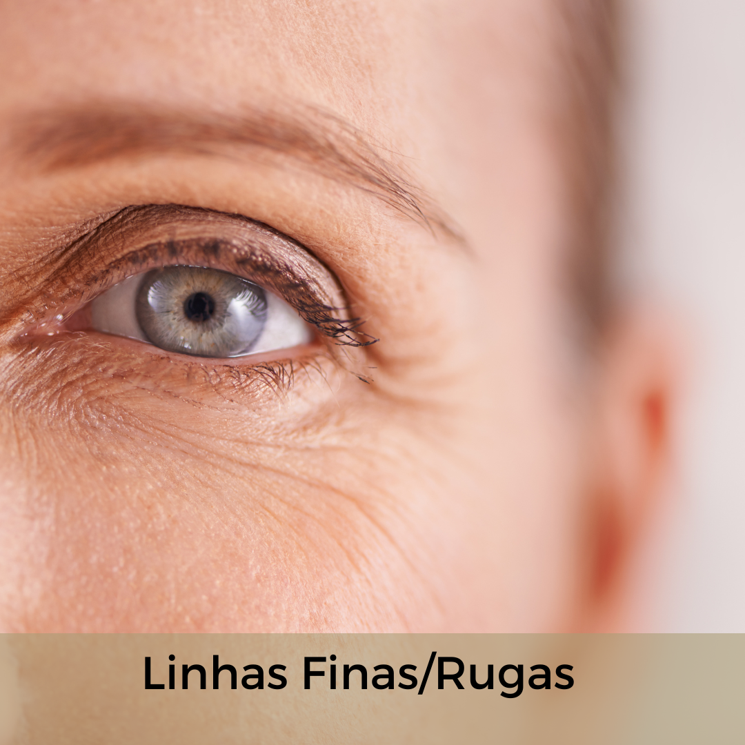 Quais problemas em relação a sua pele facial te preocupam hoje? Selecione quantas alternativas desejar.