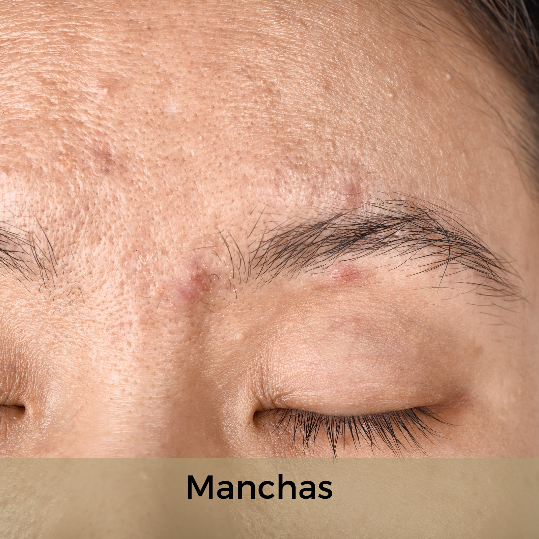 Quais problemas em relação a sua pele facial te preocupam hoje? Selecione quantas alternativas desejar.